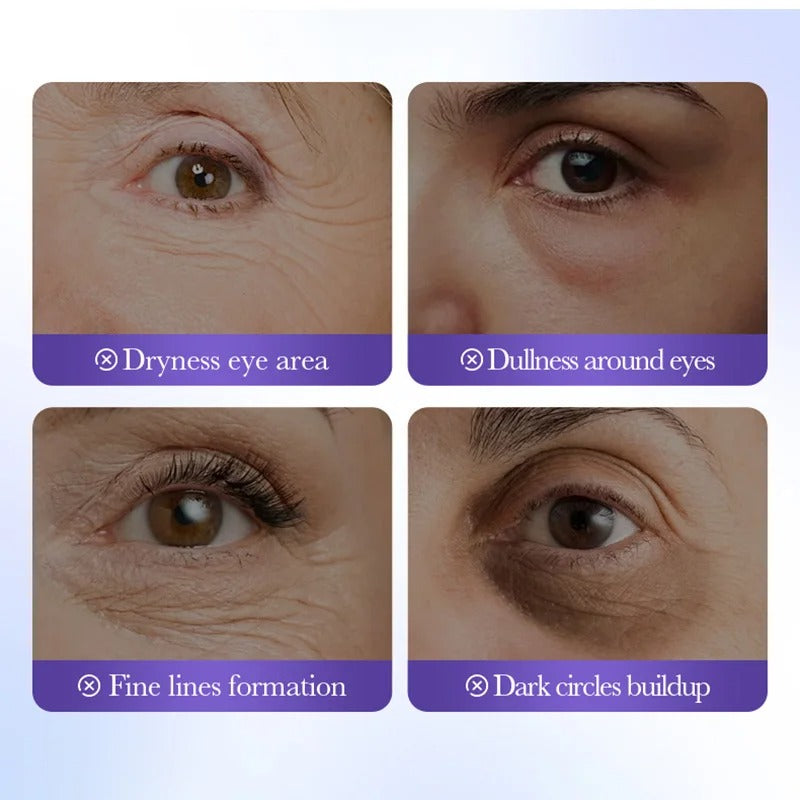 Skyn™ Retinol Eye Mask