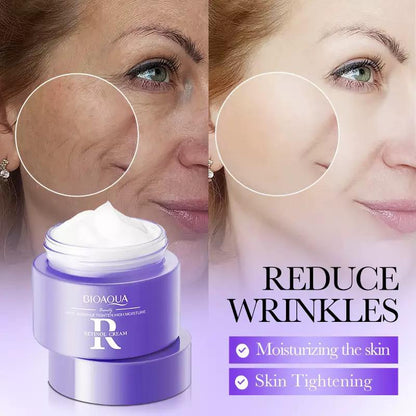 Skyn™ Retinol Cream