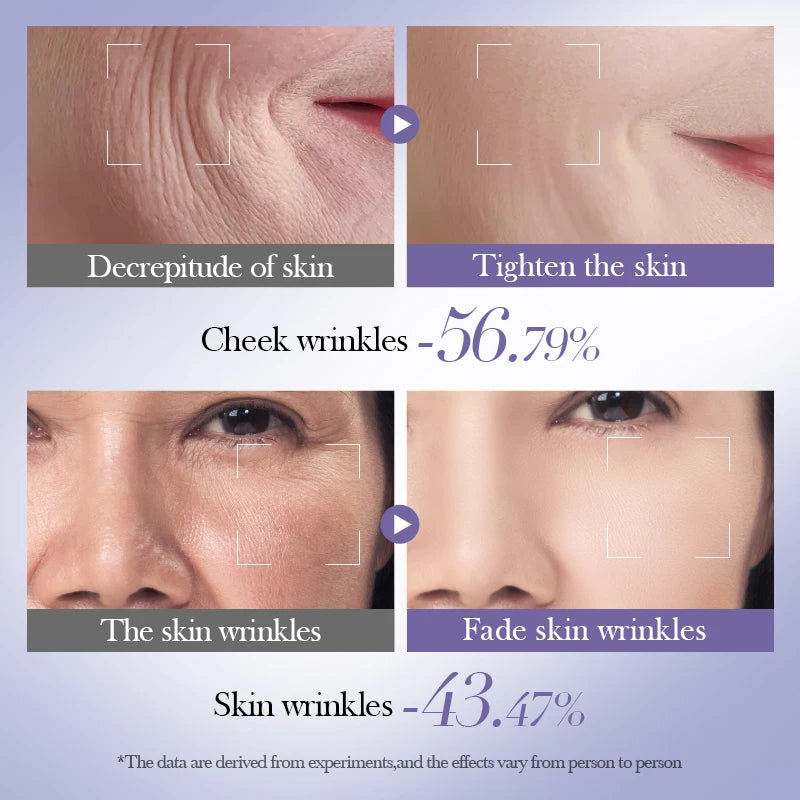Skyn™ Retinol Full Set